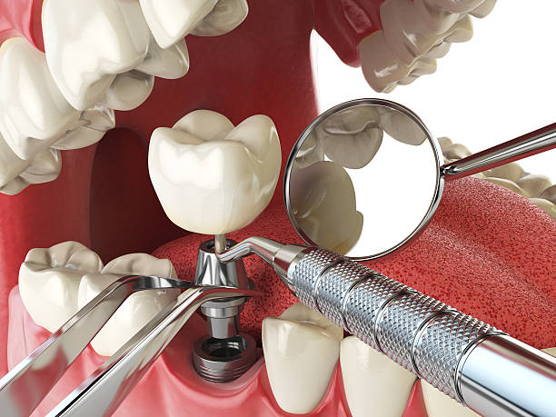 Best Urgent Dental Care for Toothache in Edburgh, IN