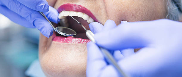 Best Emergency Dental Extractions in Edburgh, IN