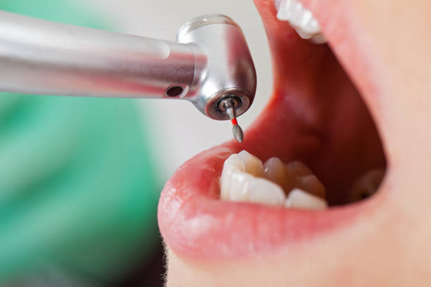 Best Pediatric Emergency Dentist in Edburgh, IN